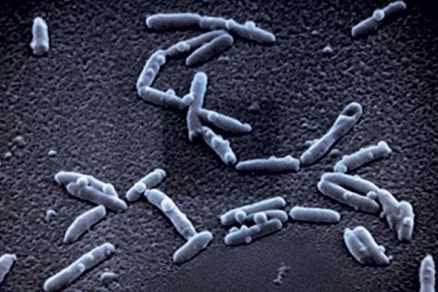 Legionella pneumophila je parazit, který vniká do lidských buněk a způsobuje tzv. legionářskou nemoc. Ta má podobný průběh jako zápal plic. Pro lidi s oslabenou imunitou představuje životu nebezpečné onemocnění.